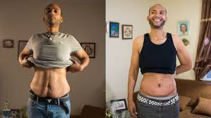 What Happens to Your Body After Major Weight Loss?