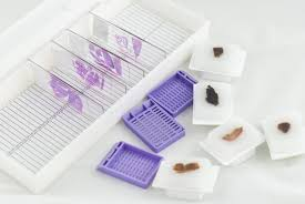Essential Considerations For Ordering FFPE Slides For Studies